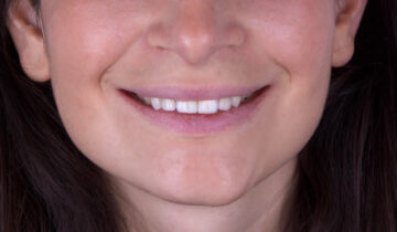 Perché il tuo sorriso è importante.
