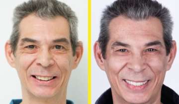 Il Dr Galvani ci spiega l’importanza di un sorriso bello e naturale.