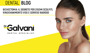 Bichectomia: il segreto per zigomi scolpiti, ringiovanimento viso e sorriso radioso