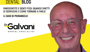 Parodontite e denti fissi: quando smetti di sorridere e come tornare a farlo.